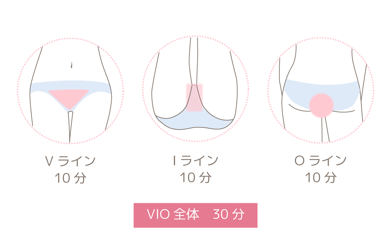VIO脱毛所要時間目安